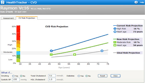 CVD Risk Projection - HealthTracker Screenshot